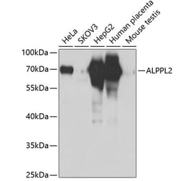 Western Blot - Anti-ALPPL2 Antibody (A12030) - Antibodies.com