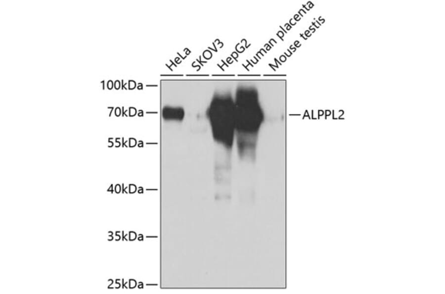 Western Blot - Anti-ALPPL2 Antibody (A12030) - Antibodies.com