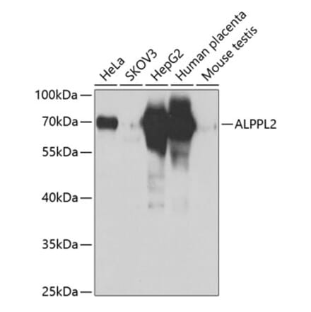 Western Blot - Anti-ALPPL2 Antibody (A12030) - Antibodies.com