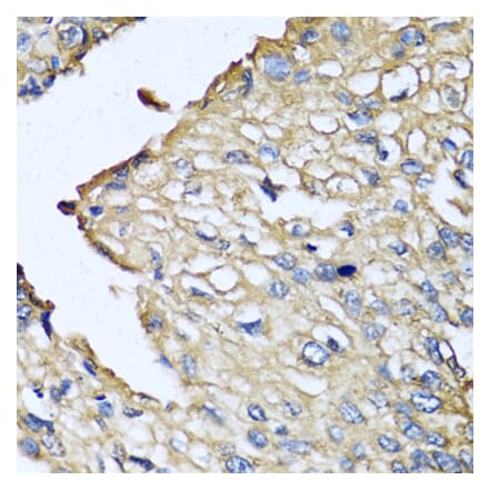 Immunohistochemistry - Anti-ASIP Antibody (A12031) - Antibodies.com