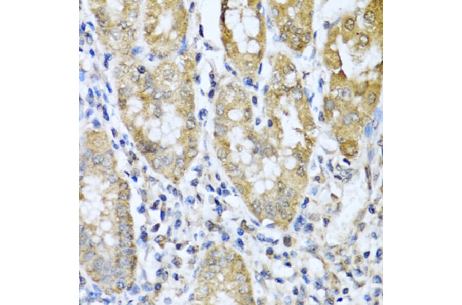 Immunohistochemistry - Anti-ASIP Antibody (A12031) - Antibodies.com
