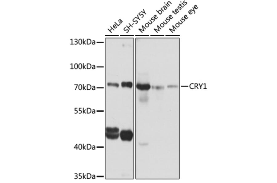 Western Blot - Anti-CRY1 Antibody (A6890) - Antibodies.com