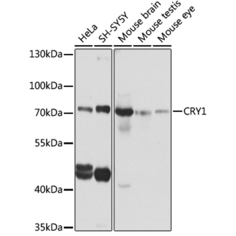 Western Blot - Anti-CRY1 Antibody (A6890) - Antibodies.com