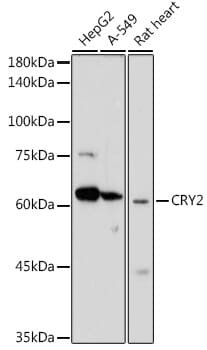 Western blot analysis of extracts of rat brain, using Anti-CRY2 Antibody (A6891) at 1:1,000 dilution.
Secondary antibody: Goat Anti-Rabbit IgG (H+L) (HRP) (AS014) at 1:10,000 dilution.
Lysates / proteins: 25µg per lane.
Blocking buffer: 3% non-fat dry milk in TBST.
Detection: ECL Basic Kit (RM00020).
Exposure time: 3s.