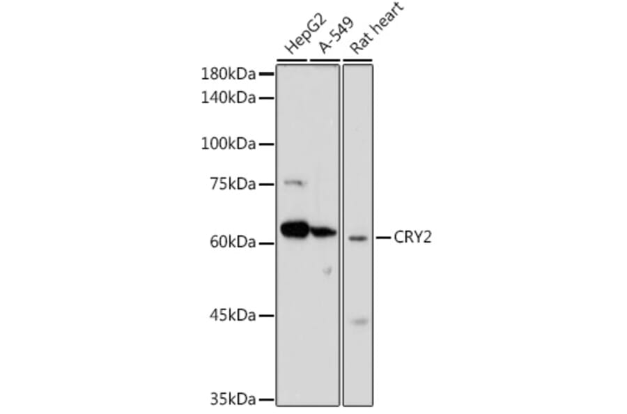 Western Blot - Anti-CRY2 Antibody (A12034) - Antibodies.com
