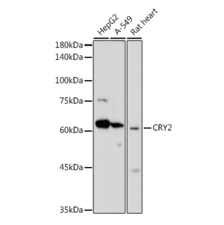 Western Blot - Anti-CRY2 Antibody (A12034) - Antibodies.com