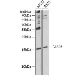 Western Blot - Anti-FABP6 Antibody (A12036) - Antibodies.com