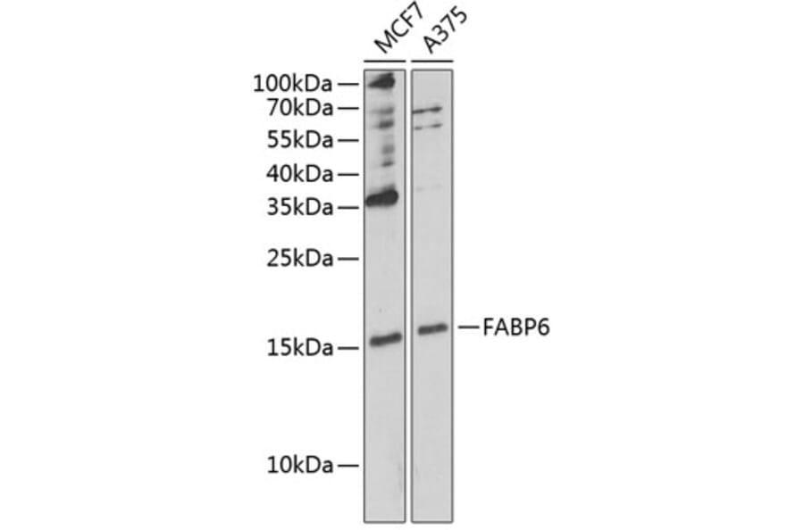 Western Blot - Anti-FABP6 Antibody (A12036) - Antibodies.com