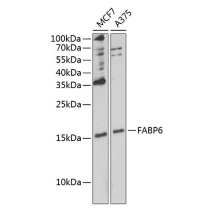 Western Blot - Anti-FABP6 Antibody (A12036) - Antibodies.com