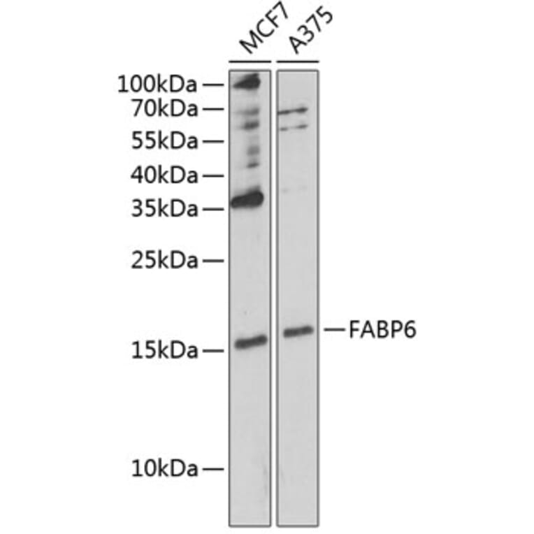 Western Blot - Anti-FABP6 Antibody (A12036) - Antibodies.com