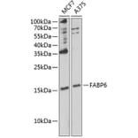 Western Blot - Anti-FABP6 Antibody (A12036) - Antibodies.com