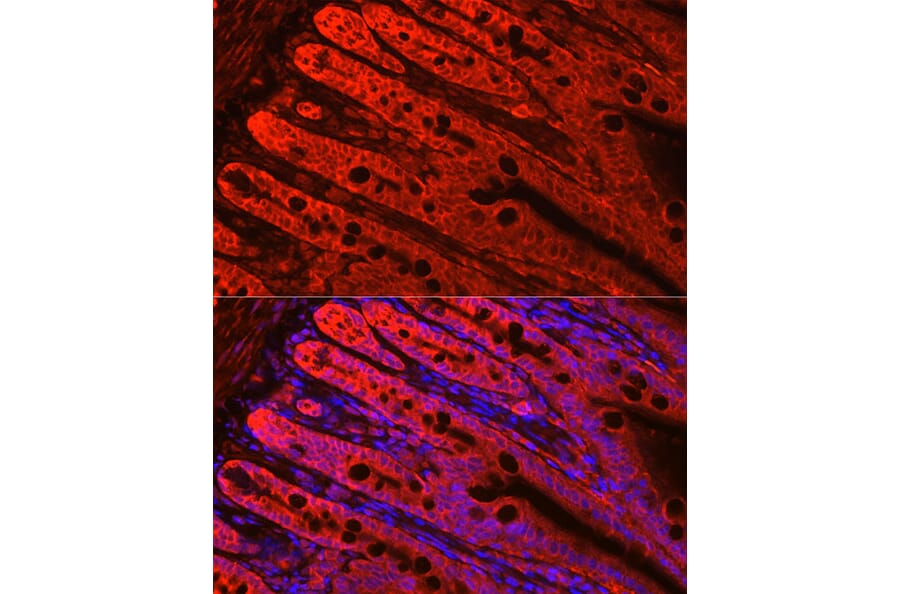 Immunofluorescence - Anti-FABP6 Antibody (A12036) - Antibodies.com
