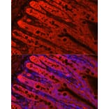 Immunofluorescence - Anti-FABP6 Antibody (A12036) - Antibodies.com