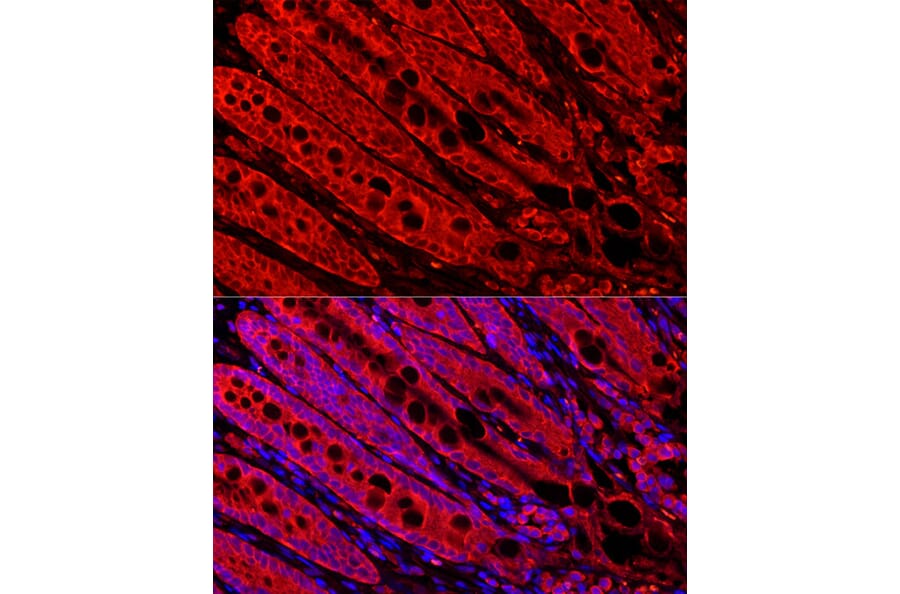 Immunofluorescence - Anti-FABP6 Antibody (A12036) - Antibodies.com