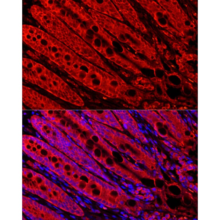 Immunofluorescence - Anti-FABP6 Antibody (A12036) - Antibodies.com