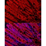 Immunofluorescence - Anti-FABP6 Antibody (A12036) - Antibodies.com