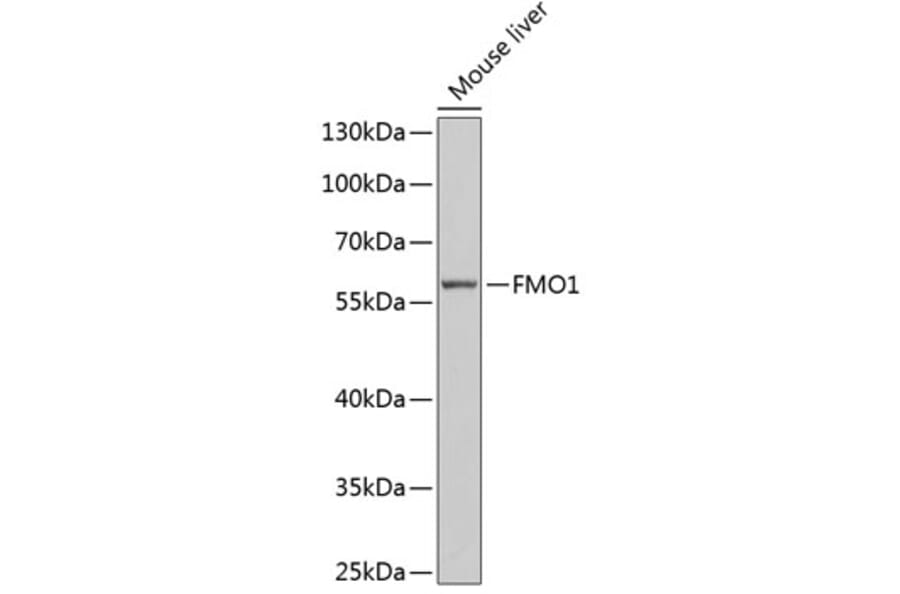 Western Blot - Anti-FMO1 Antibody (A6908) - Antibodies.com
