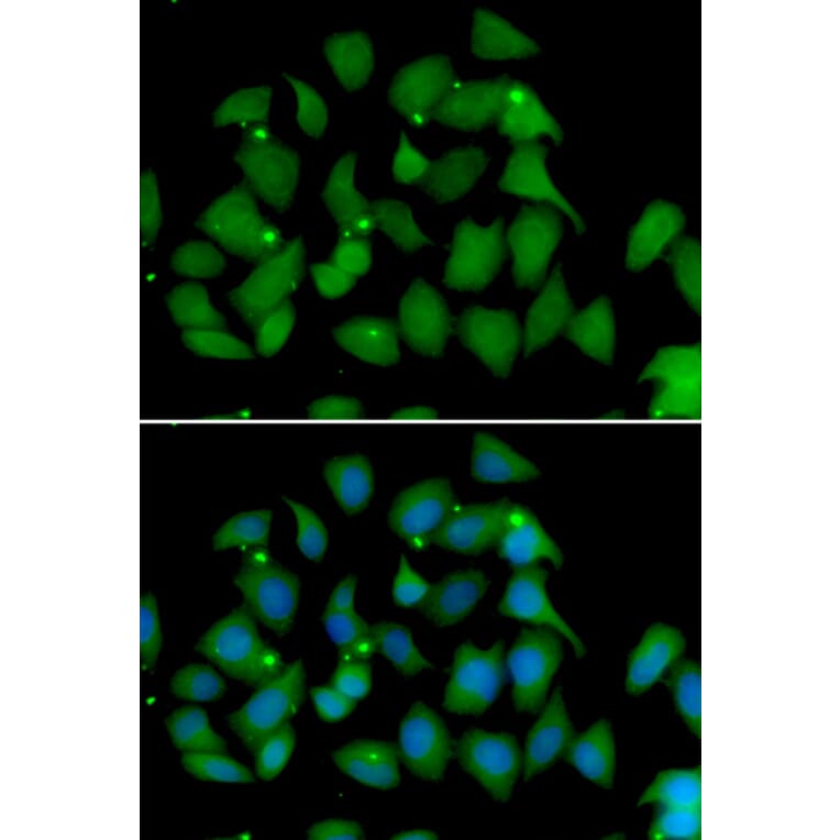 Immunofluorescence - Anti-FMO1 Antibody (A6908) - Antibodies.com