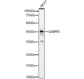 Western Blot - Anti-GABPB2 Antibody (A12038) - Antibodies.com
