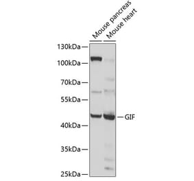 Western Blot - Anti-Intrinsic Factor Antibody (A12039) - Antibodies.com