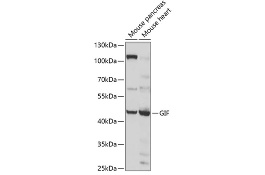 Western Blot - Anti-Intrinsic Factor Antibody (A12039) - Antibodies.com