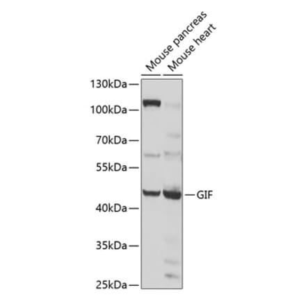 Western Blot - Anti-Intrinsic Factor Antibody (A12039) - Antibodies.com