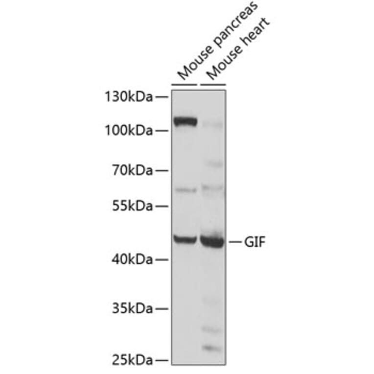 Western Blot - Anti-Intrinsic Factor Antibody (A12039) - Antibodies.com