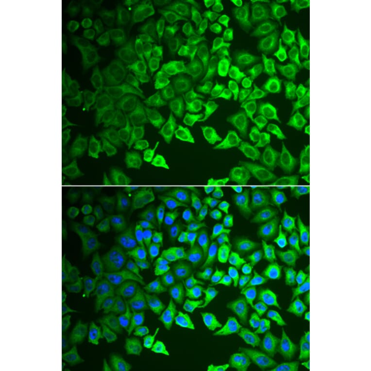 Immunofluorescence - Anti-Intrinsic Factor Antibody (A12039) - Antibodies.com