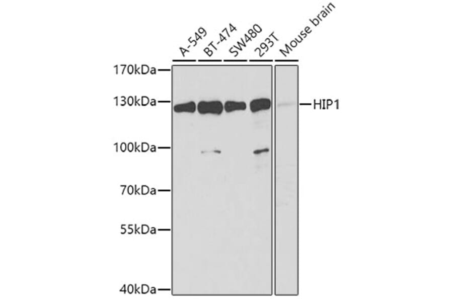 Western Blot - Anti-HIP1 Antibody (A12040) - Antibodies.com