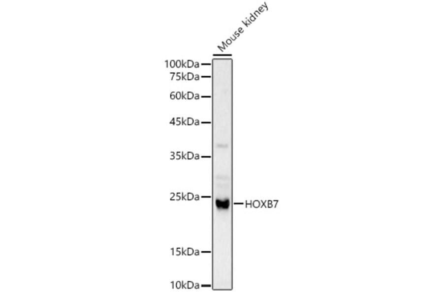 Western Blot - Anti-HOXB7 Antibody (A12041) - Antibodies.com