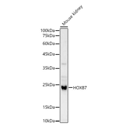 Western Blot - Anti-HOXB7 Antibody (A12041) - Antibodies.com