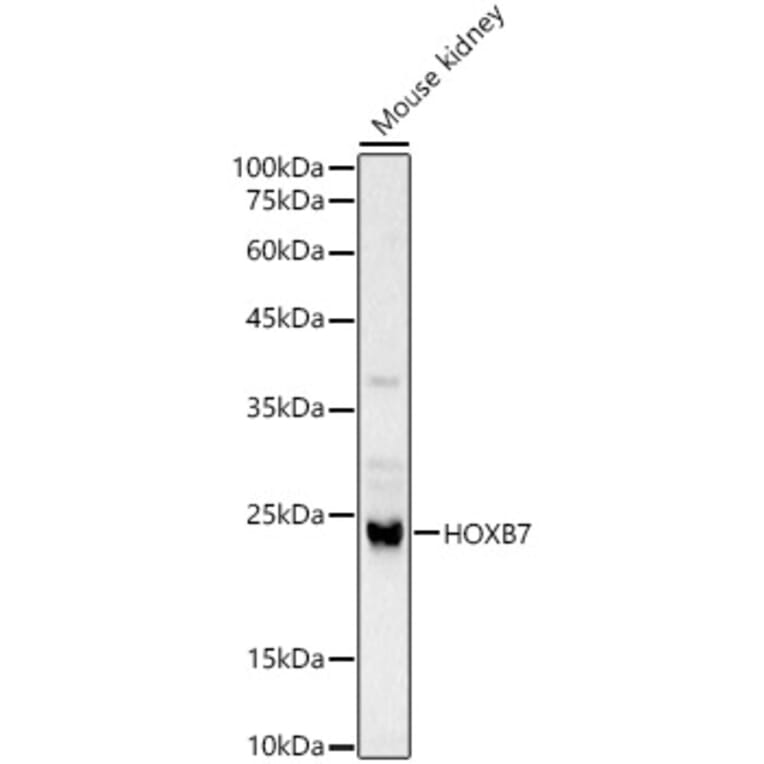 Western Blot - Anti-HOXB7 Antibody (A12041) - Antibodies.com
