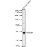 Western Blot - Anti-HOXB7 Antibody (A12041) - Antibodies.com