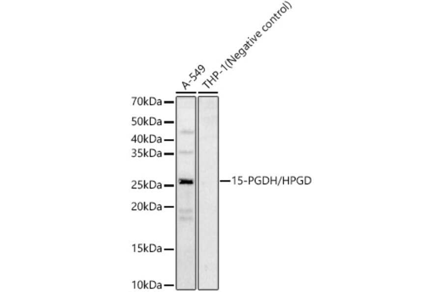 Western Blot - Anti-15-PGDH Antibody (A12042) - Antibodies.com