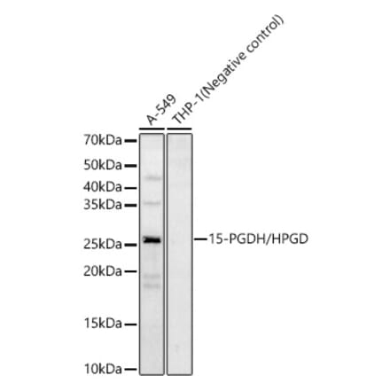 Western Blot - Anti-15-PGDH Antibody (A12042) - Antibodies.com