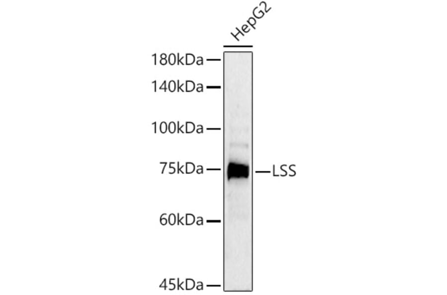 Western Blot - Anti-LSS Antibody (A12043) - Antibodies.com