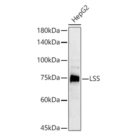 Western Blot - Anti-LSS Antibody (A12043) - Antibodies.com