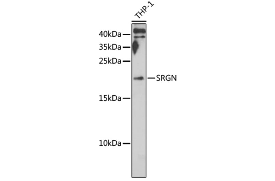 Western Blot - Anti-Serglycin Antibody (A12044) - Antibodies.com