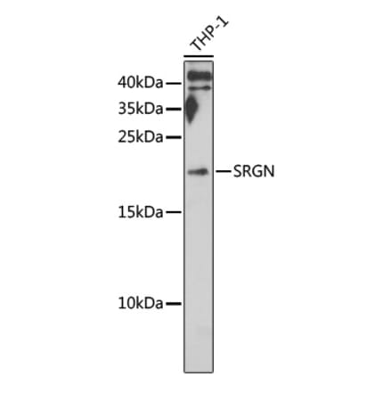 Western Blot - Anti-Serglycin Antibody (A12044) - Antibodies.com