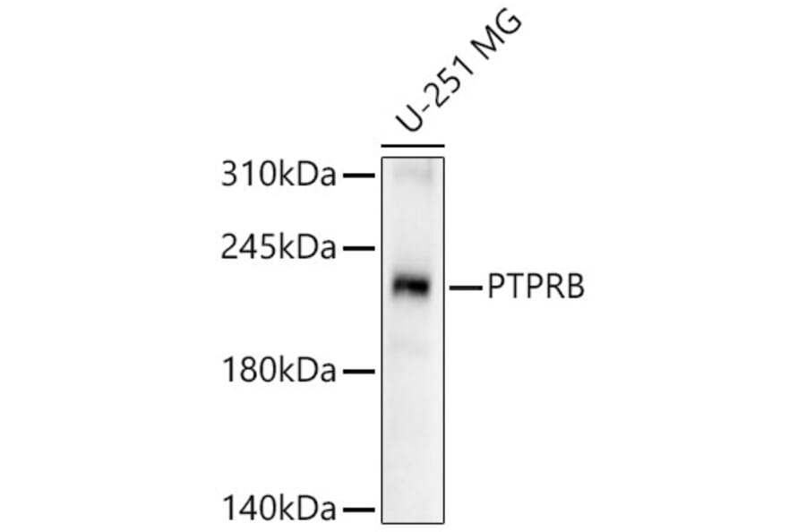 Western Blot - Anti-VE-PTP Antibody (A12045) - Antibodies.com
