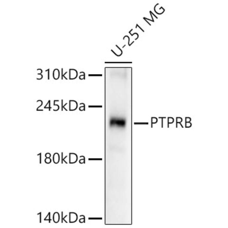 Western Blot - Anti-VE-PTP Antibody (A12045) - Antibodies.com