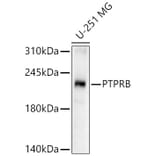 Western Blot - Anti-VE-PTP Antibody (A12045) - Antibodies.com