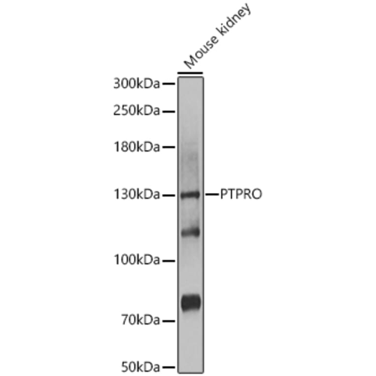 Western Blot - Anti-GLEPP1/PTPRO Antibody (A12046) - Antibodies.com