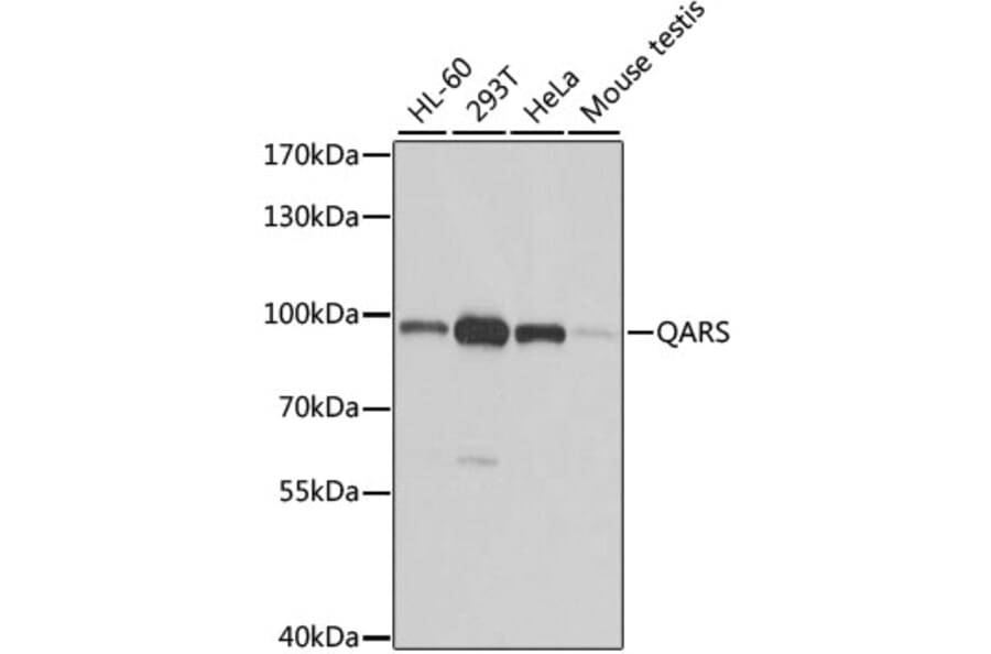 Western Blot - Anti-GlnRS Antibody (A12047) - Antibodies.com