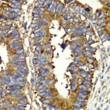 Immunohistochemistry - Anti-GlnRS Antibody (A12047) - Antibodies.com