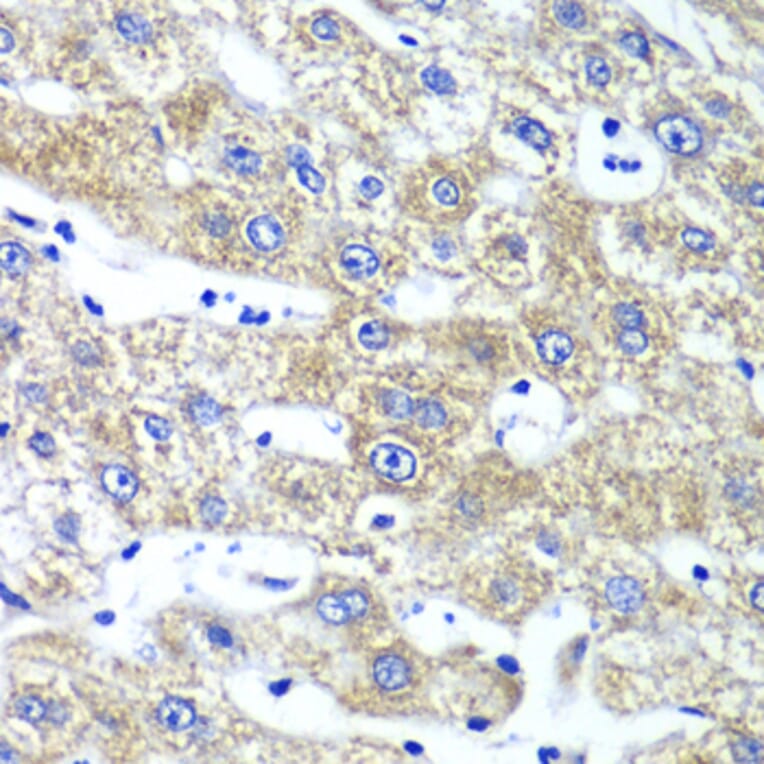 Immunohistochemistry - Anti-GlnRS Antibody (A12047) - Antibodies.com