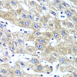 Immunohistochemistry - Anti-GlnRS Antibody (A12047) - Antibodies.com