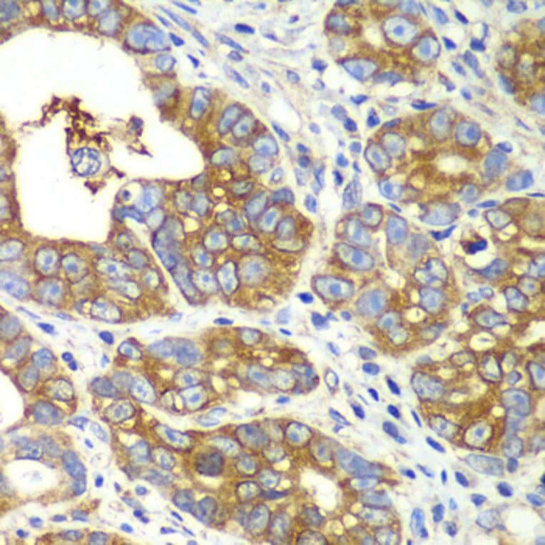 Immunohistochemistry - Anti-GlnRS Antibody (A12047) - Antibodies.com