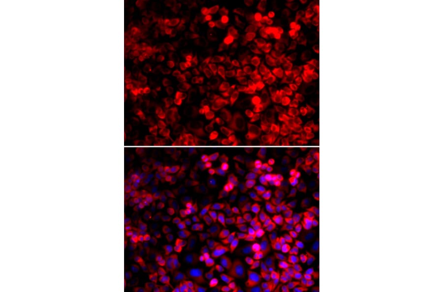 Immunofluorescence - Anti-GlnRS Antibody (A12047) - Antibodies.com