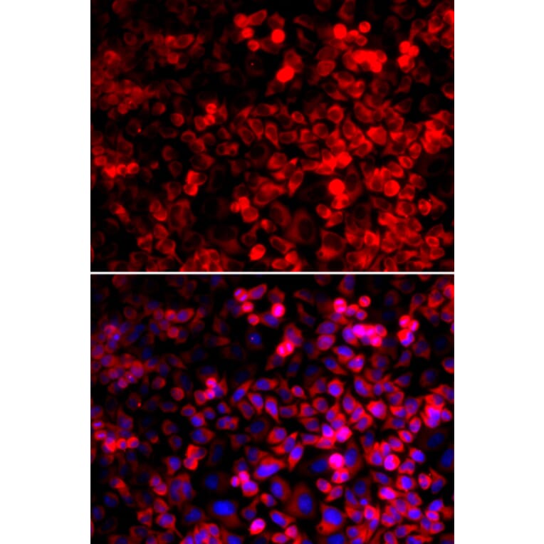 Immunofluorescence - Anti-GlnRS Antibody (A12047) - Antibodies.com